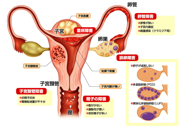 子宮口精子注射画像 ウィメンズクリニック糸数